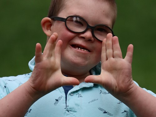 Young person with Downs Syndrome .jpg